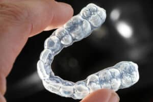 Are Clear Aligners as Effective as Traditional Braces? Torres Orthodontics in Tampa and Miami Lakes, FL