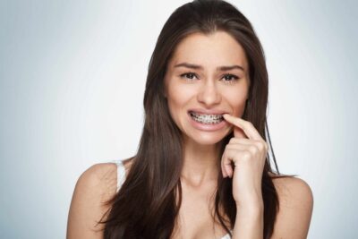 Do Braces Hurt? What to Expect During Treatment at Torres Orthodontics in Tampa and Miami Lakes, FL