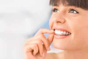 Is Invisalign Faster Than Braces? Miami Lakes